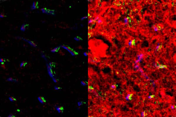  Fluorescence images of the brainstem obtained from nontumor mice after intranasal delivery (left) and FUSIN delivery (right). The brainstem, where the glioma was implanted, showed enhanced fluorescence signal by FUSIN compared with IN only. 